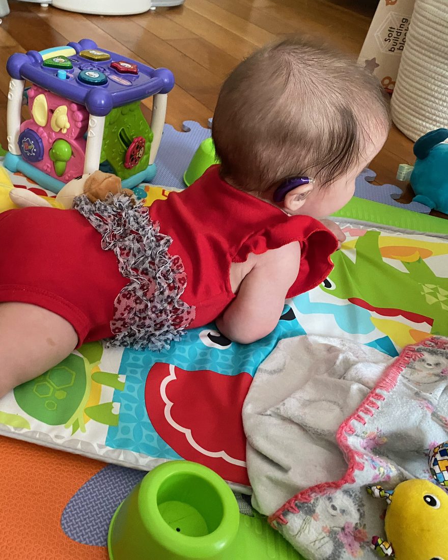 An infant wearing a hearing aid, playing on a colorful mat.